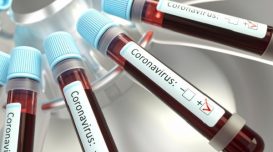 coronavirus-exame