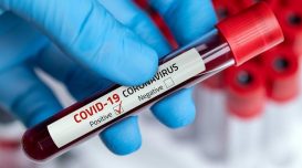 coronavirus-teste-positivo-1